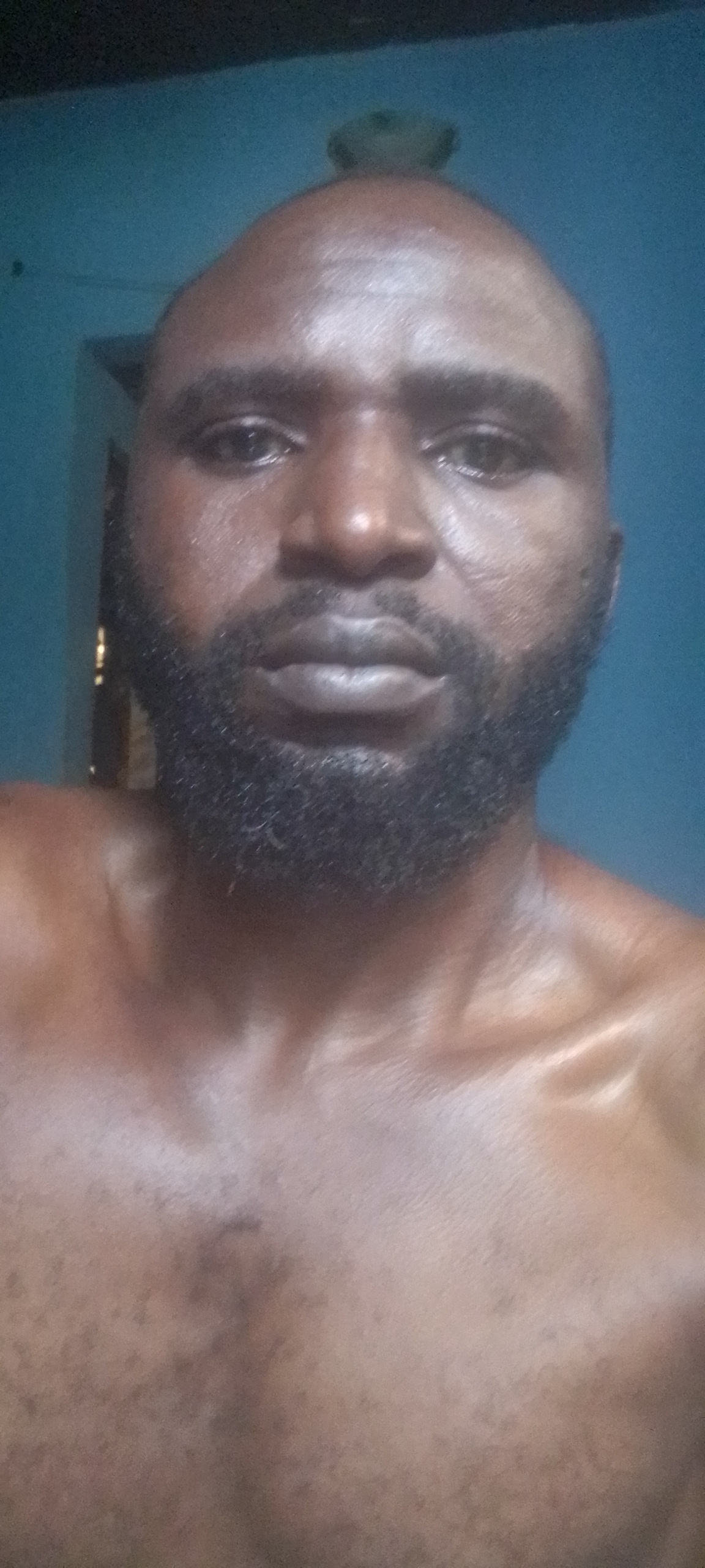 Ephraim Daniel from Plateau needs YOUR help 🩺💔. I'm fighting hernia & need surgery ASAP! 💪 Every naira counts, every share matters. Help me get the care I need 🩺. #HelpEphraim"