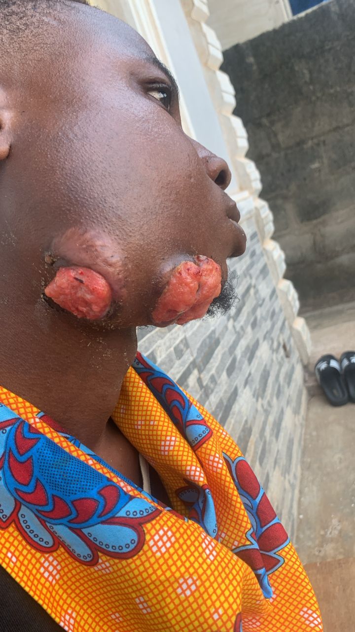C27758F1-DA74-444D-AFE8-936AD9D2A6AB Good day everyone. I hope this message finds you well. I am reaching out with a heavy heart on behalf of my beloved cousin brother who is currently battling salivary gland cancer. His treatment is urgent and the cost of surgery at Lasuth Hospital has been overwhelming for our family, amounting to 2.5 million naira.We are doing everything we can to save him, but we need support from kind-hearted individuals and public figures like yourself who can make a difference in the lives of those in need. Your influence and generosity could help us secure the life-saving treatment he urgently requires. Please find it in your heart to assist us or share his story with your followers. Any form of help or guidance would be immensely appreciated. Together, we can bring hope and relief to someone fighting for his life.Thank you so much for taking the time to read this. God bless you abundantly for your kindness and compassion.