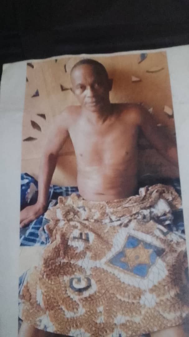 IMG-20250419-WA0006 The picture is my father who is sick, partially paralyzed. We need to seek medical attention