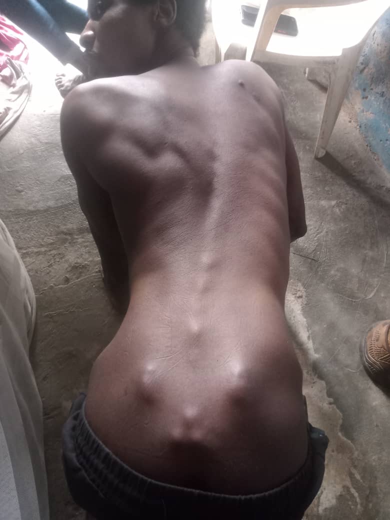 This is Bright Gideon please we need to do surgery for him to walk back