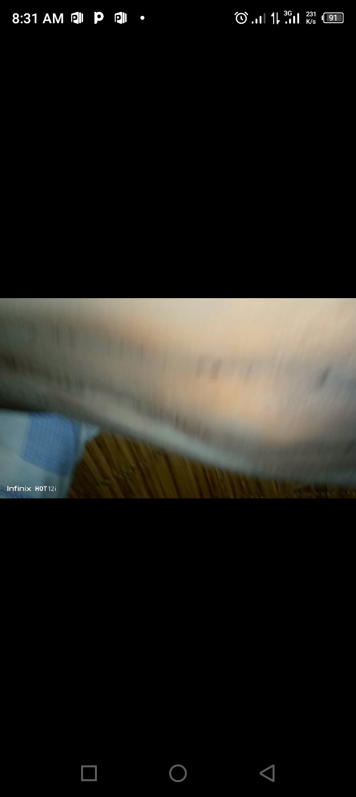 Screenshot_20240210-083115 Gibbus on my spinal cord