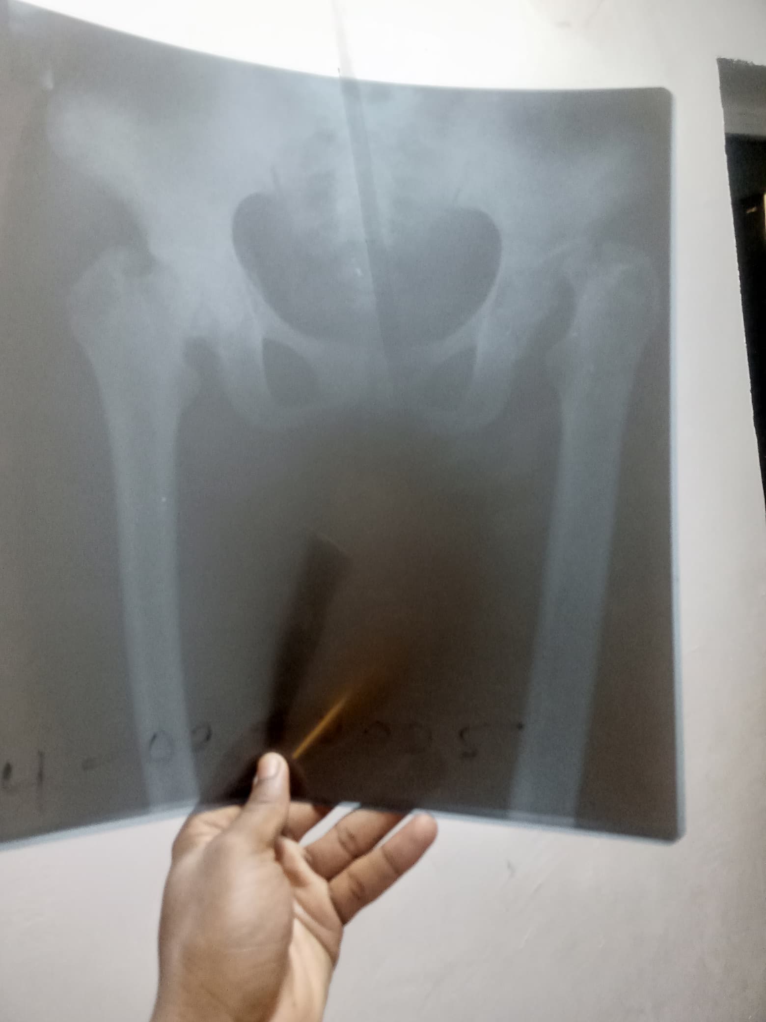 x ray file